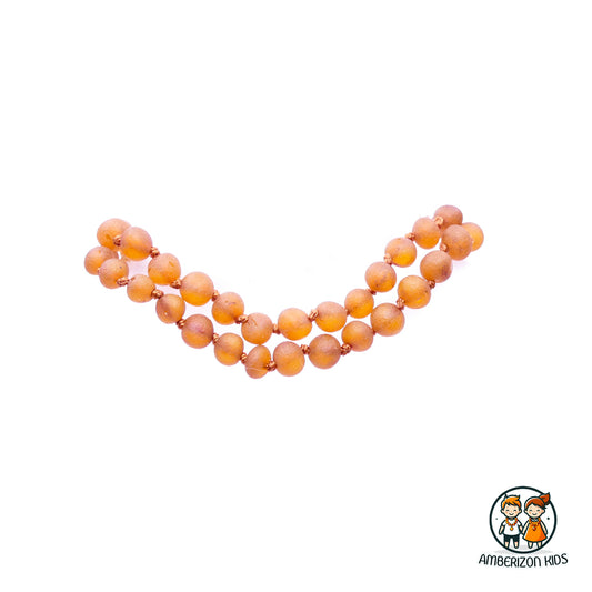Golden Amber Teething Necklace - Versatile for All Genders - Raw Frosted Finish
