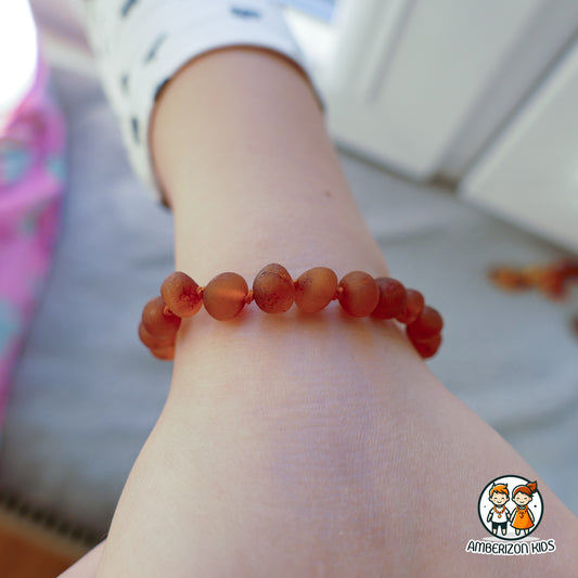 Dark orange raw amber baby bracelet-anklet - Frosted baroque beads